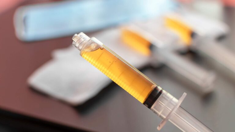 Syringes prepared for PRP, PRF, and Ozone therapy used in regenerative pain treatment